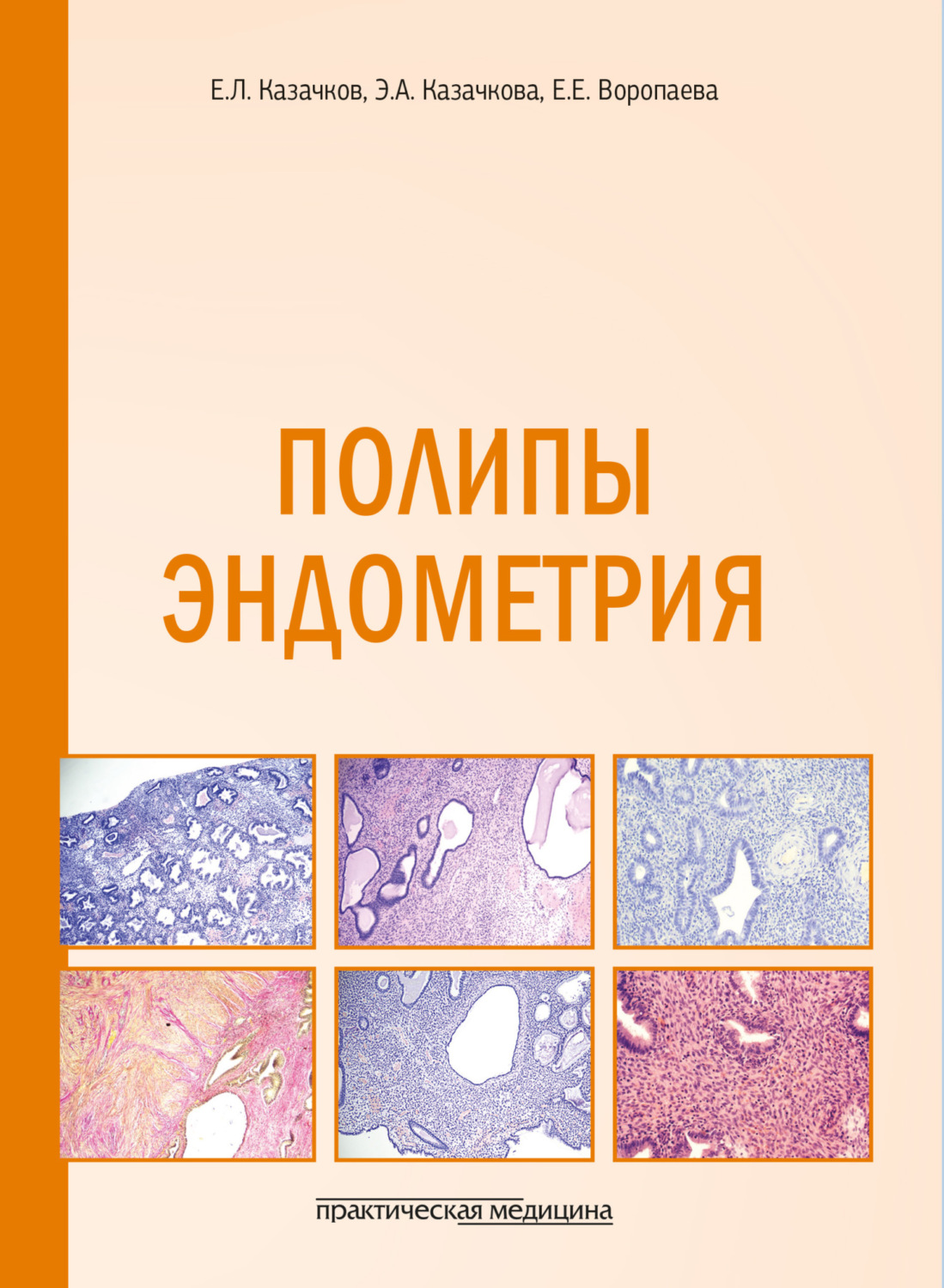 Обложка книги «Полипы эндометрия. Учебное пособие»