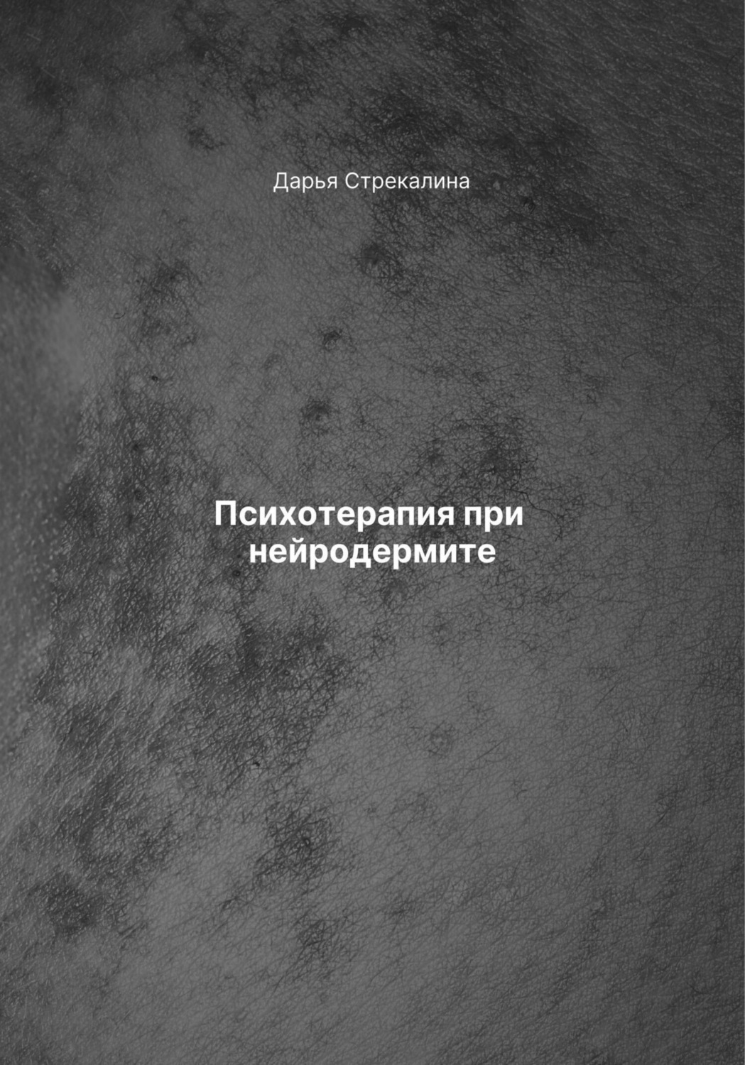 Обложка книги «Психотерапия при нейродермите»