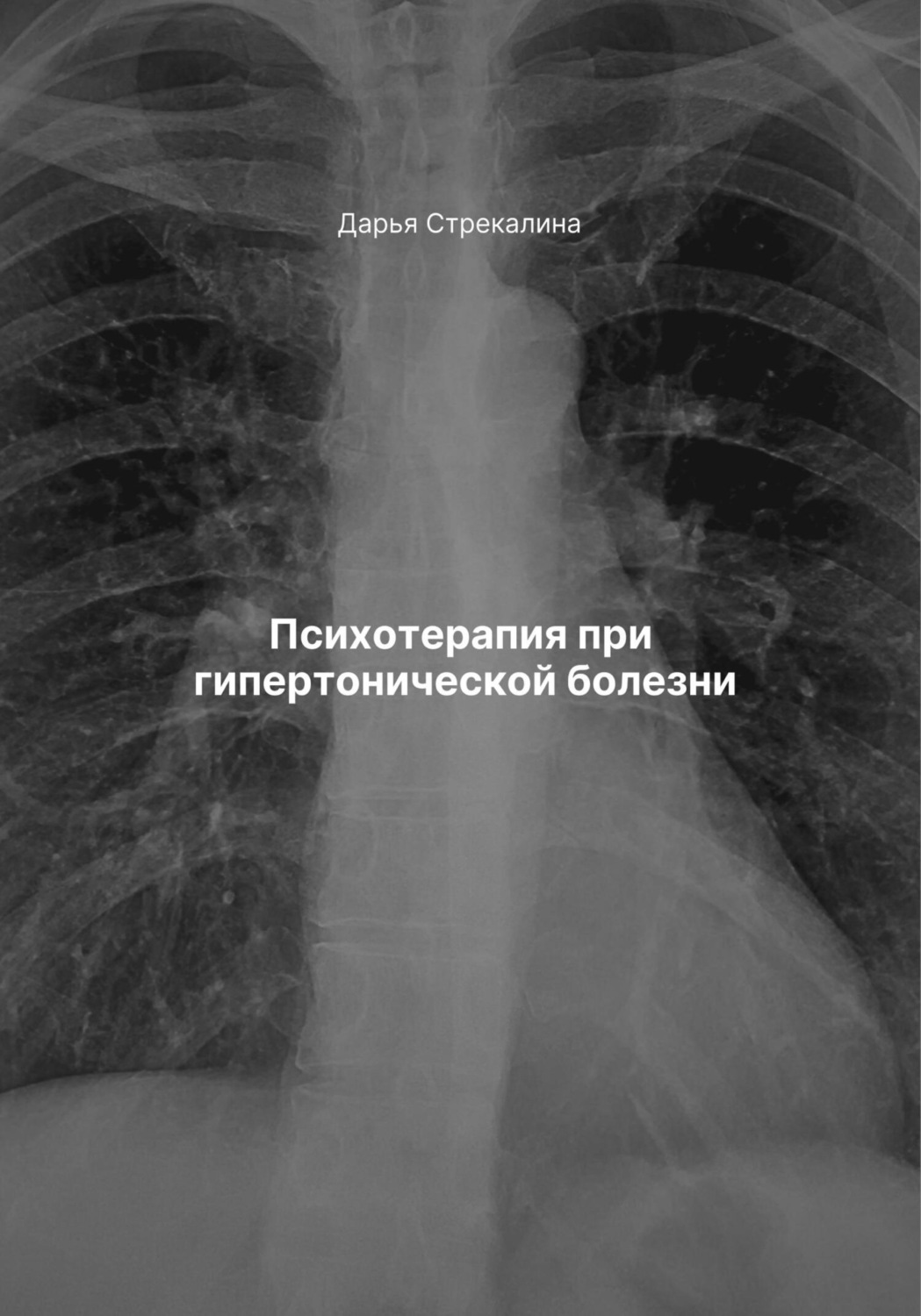 Обложка книги «Психотерапия при гипертонической болезни»