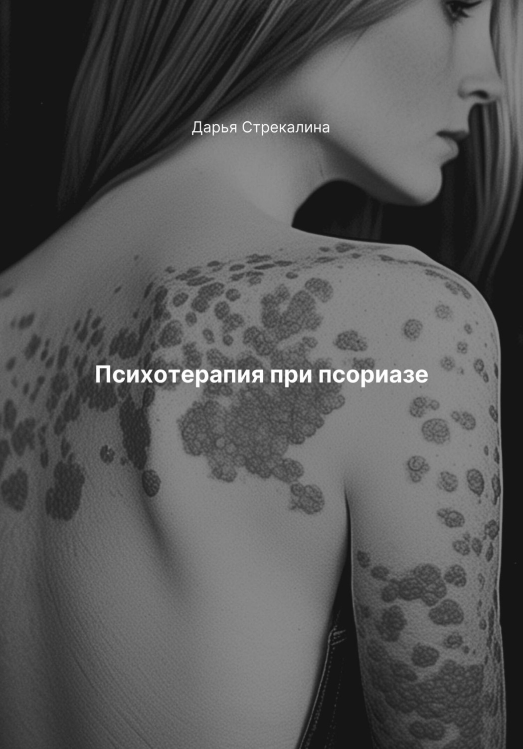 Обложка книги «Психотерапия при псориазе»