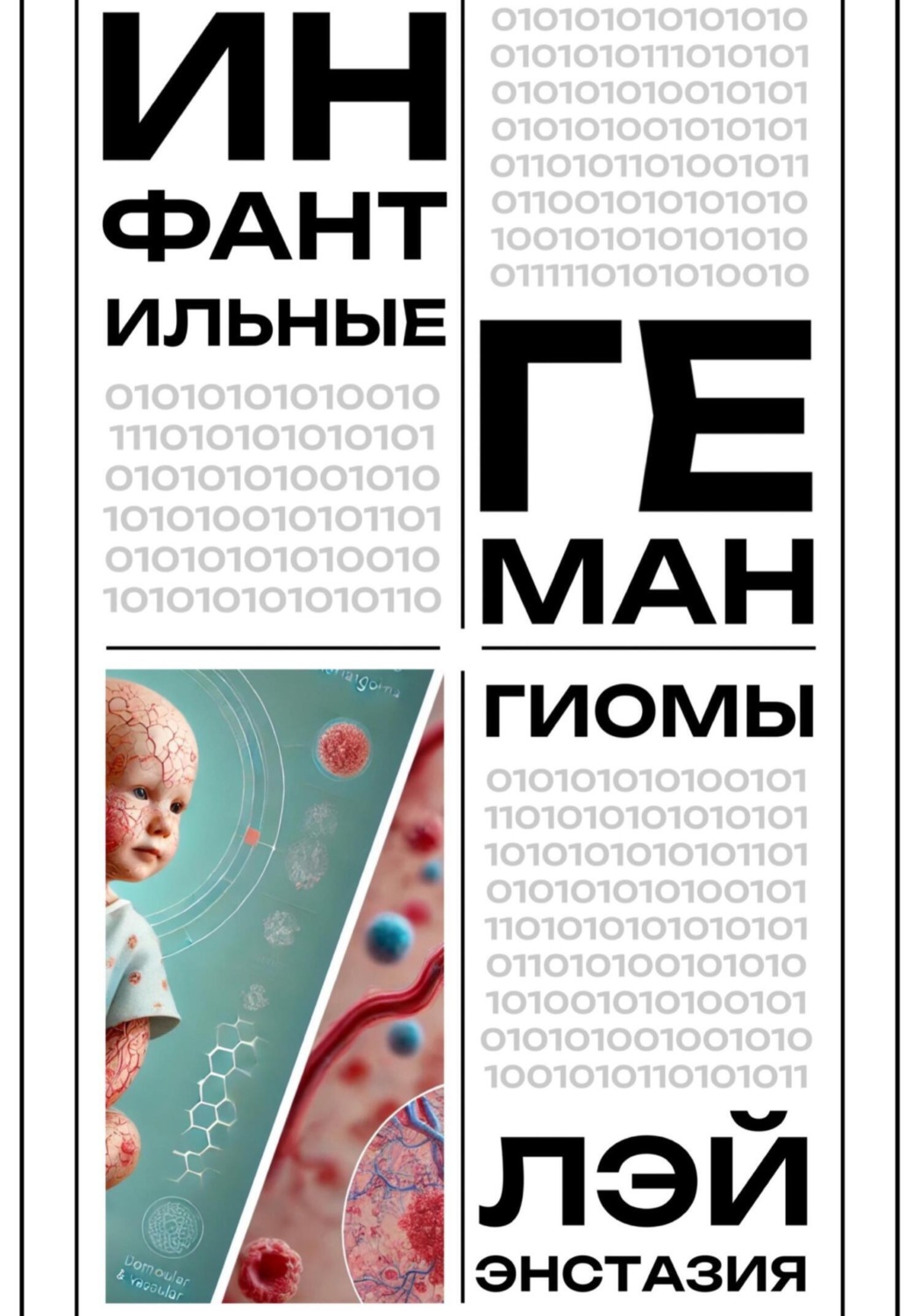 Обложка книги «Инфантильные гемангиомы»