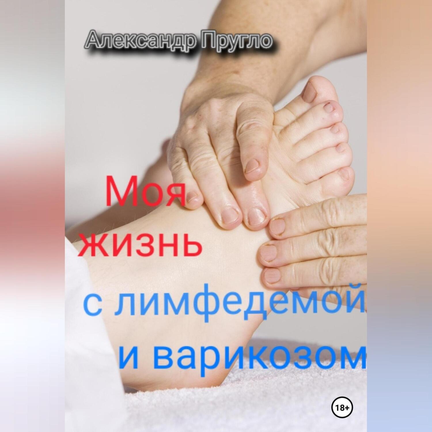 Обложка книги «Моя жизнь с лимфедемой и варикозом»
