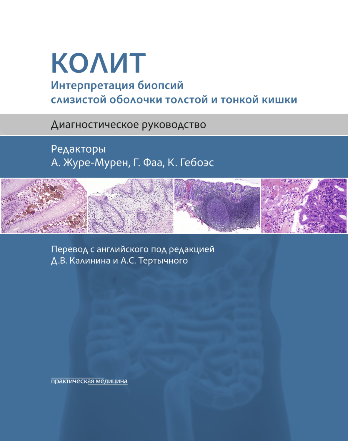 Обложка книги «Колит. Интерпретация биопсий слизистой оболочки толстой и тонкой кишки. Диагностическое руководство»