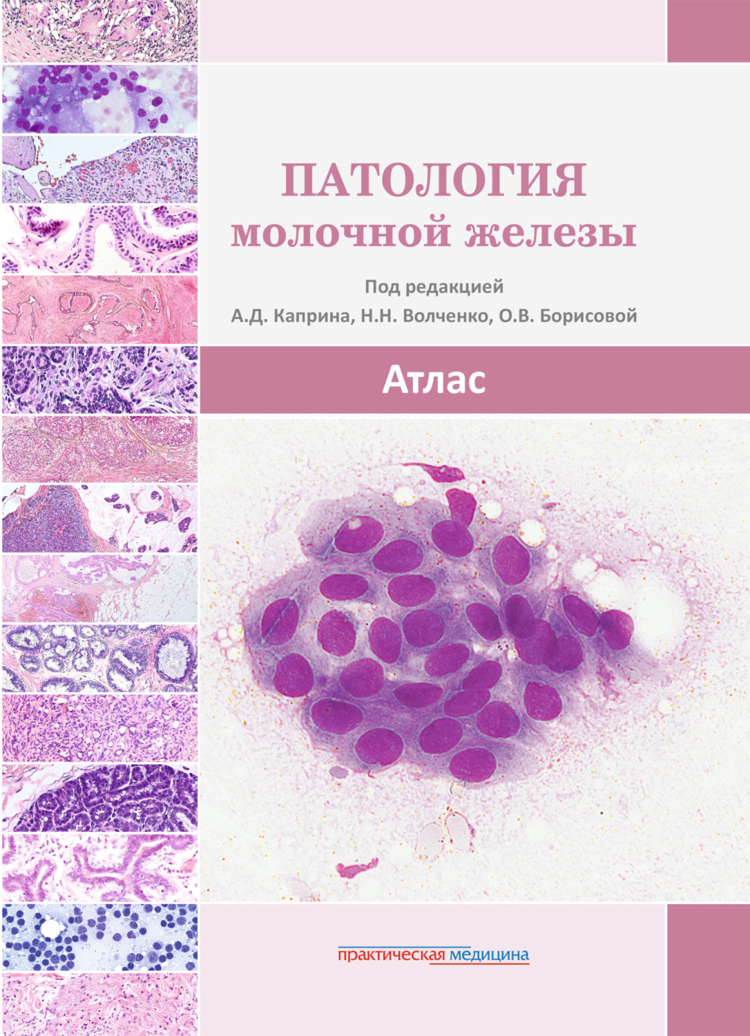 Обложка книги «Патология молочной железы. Атлас»