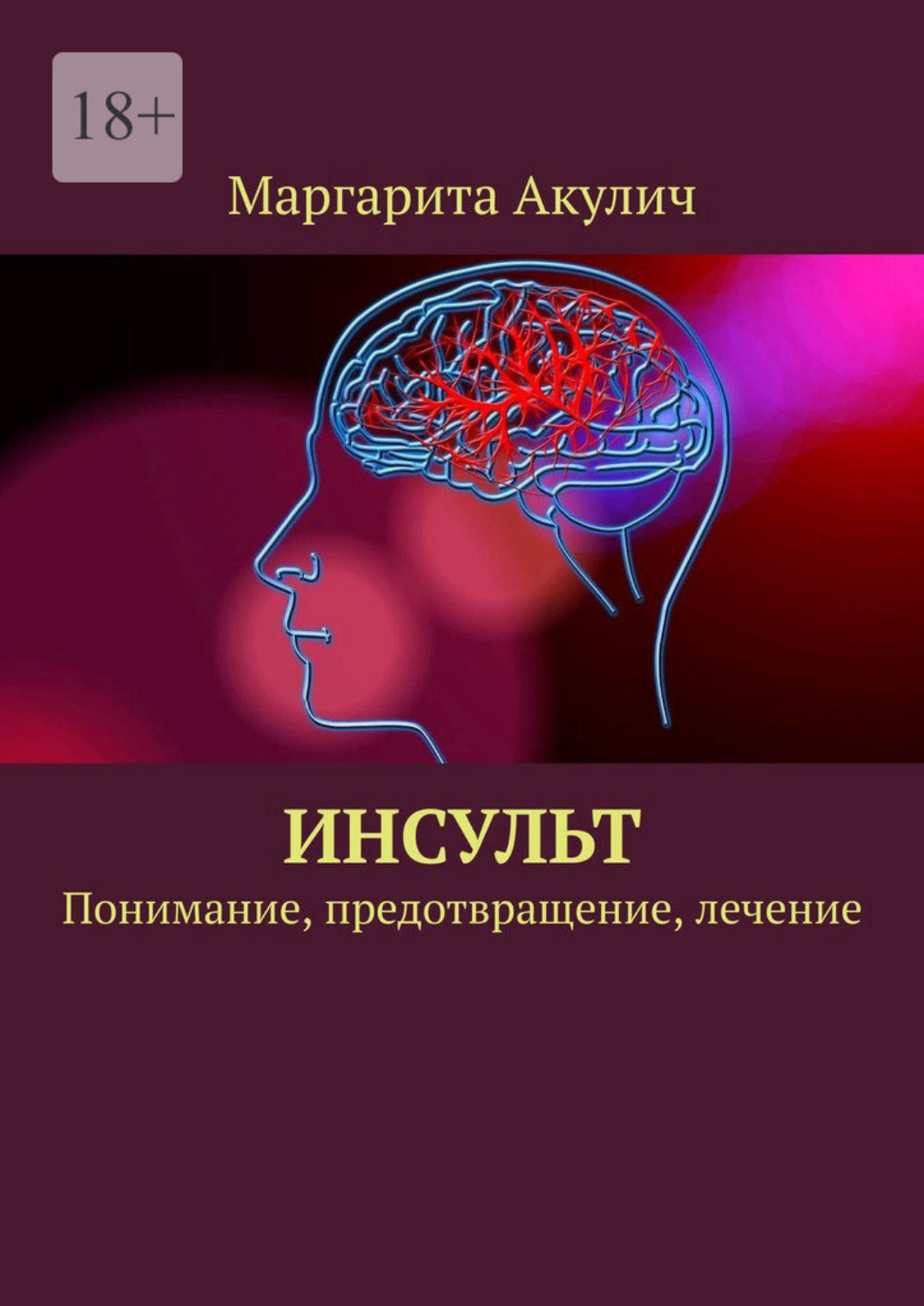 Обложка книги «Инсульт. Понимание, предотвращение, лечение»