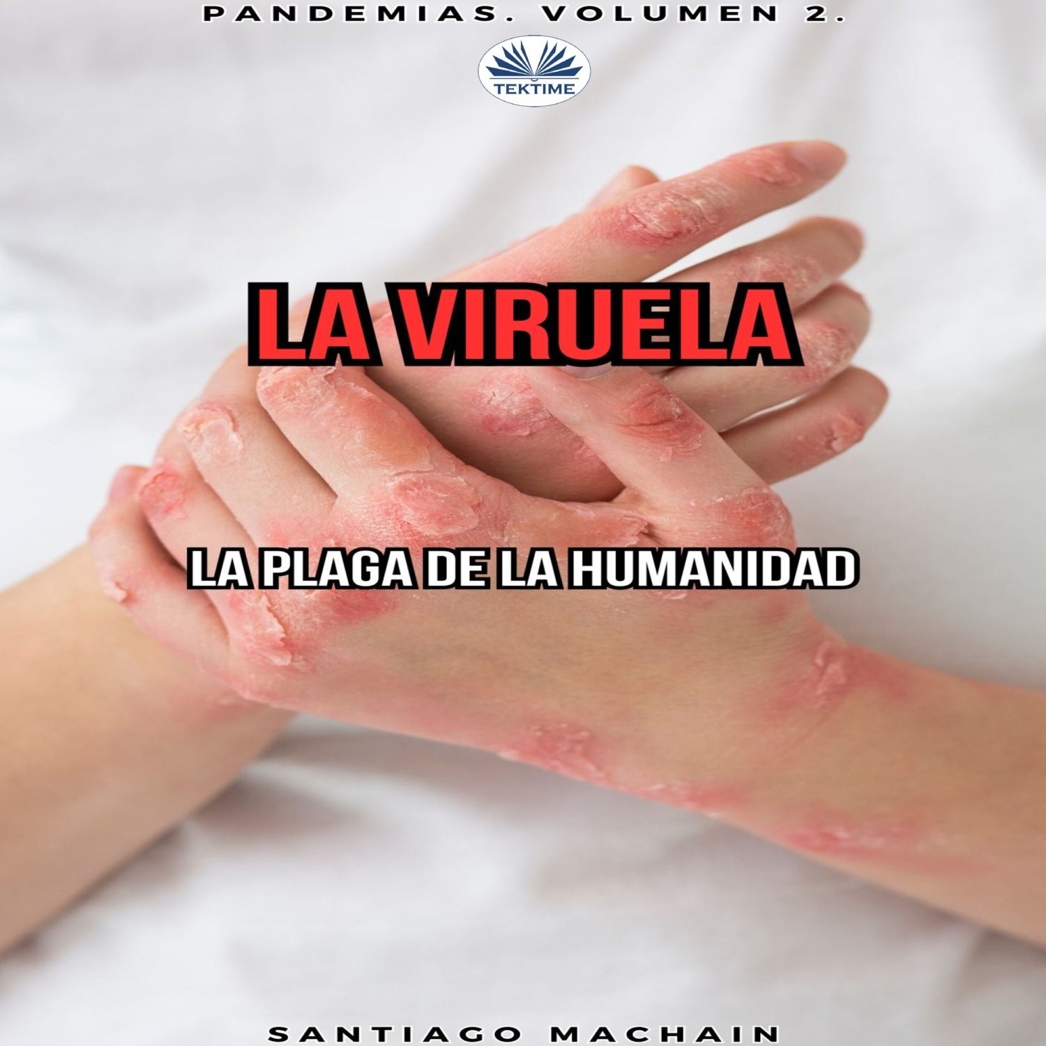 Обложка книги «La Viruela»