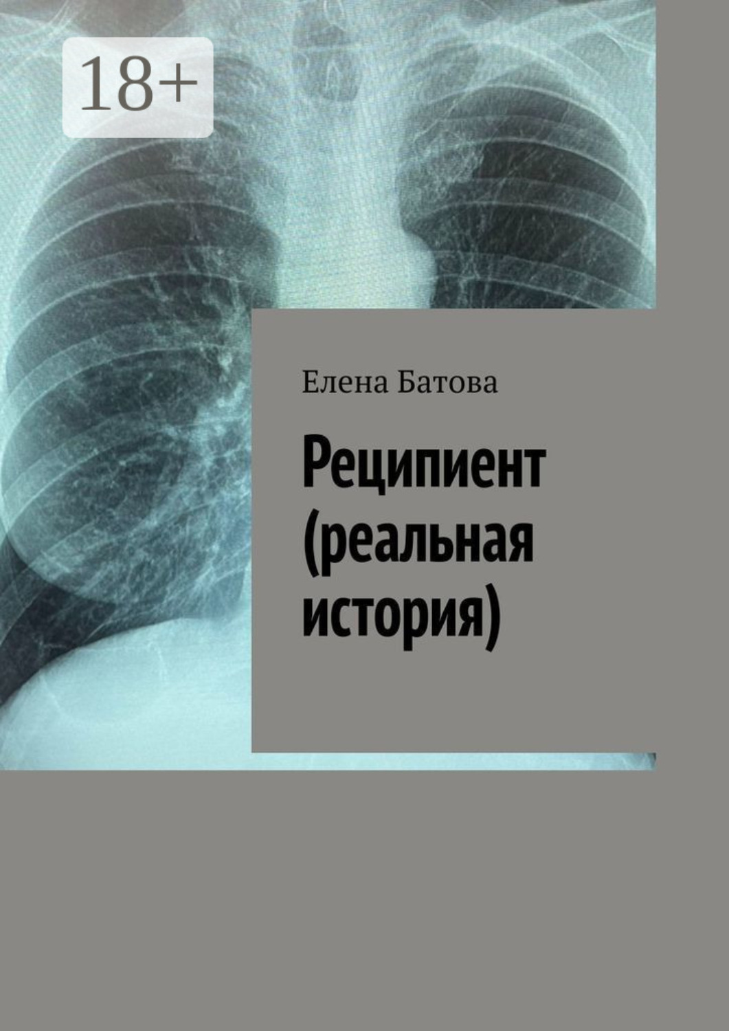 Обложка книги «Реципиент (реальная история)»