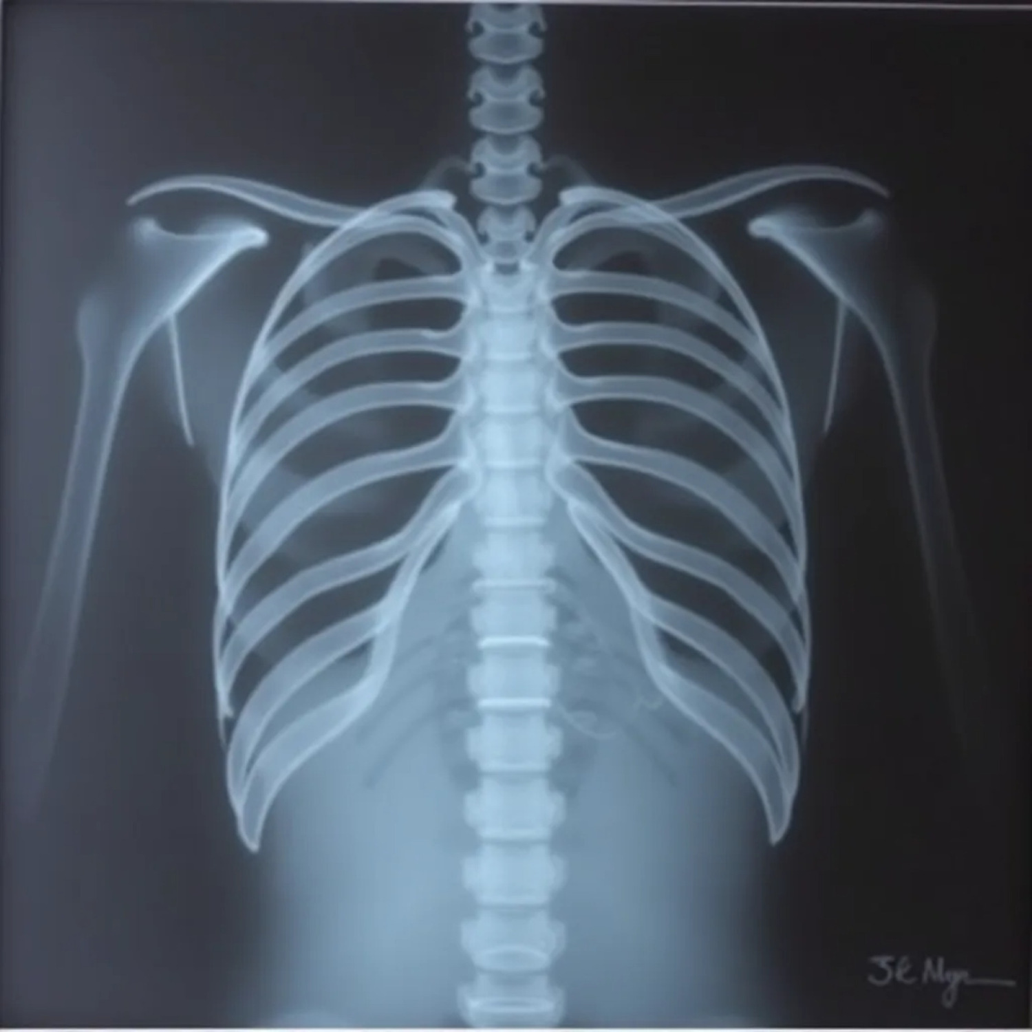 Обложка книги «Острые неинфекционные болезни легких»