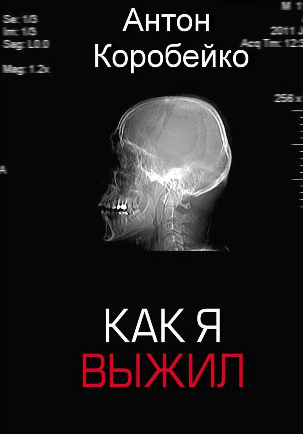Обложка книги «Как я выжил»