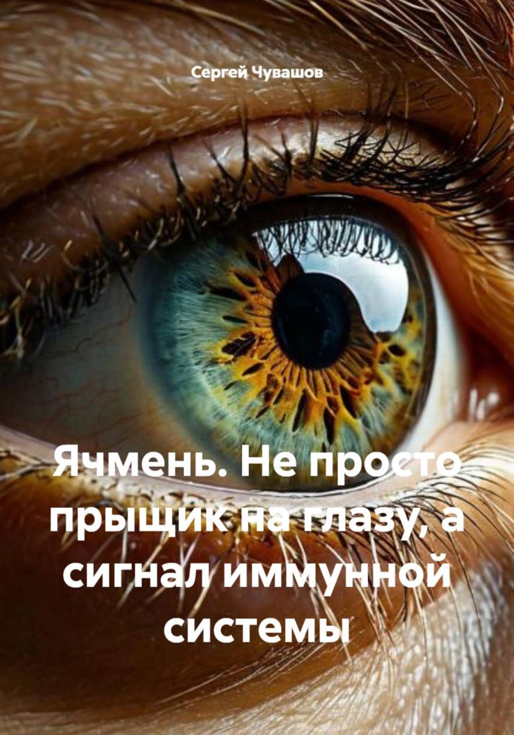 Обложка книги «Ячмень. Не просто прыщик на глазу, а сигнал иммунной системы»