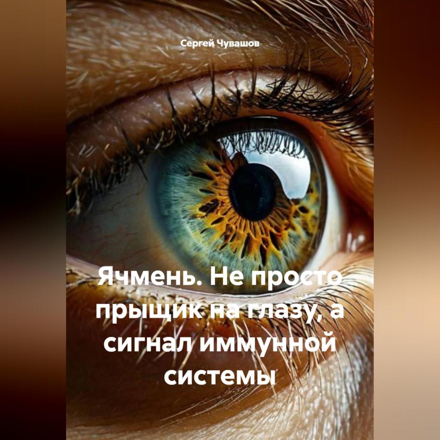 Обложка книги «Ячмень. Не просто прыщик на глазу, а сигнал иммунной системы»