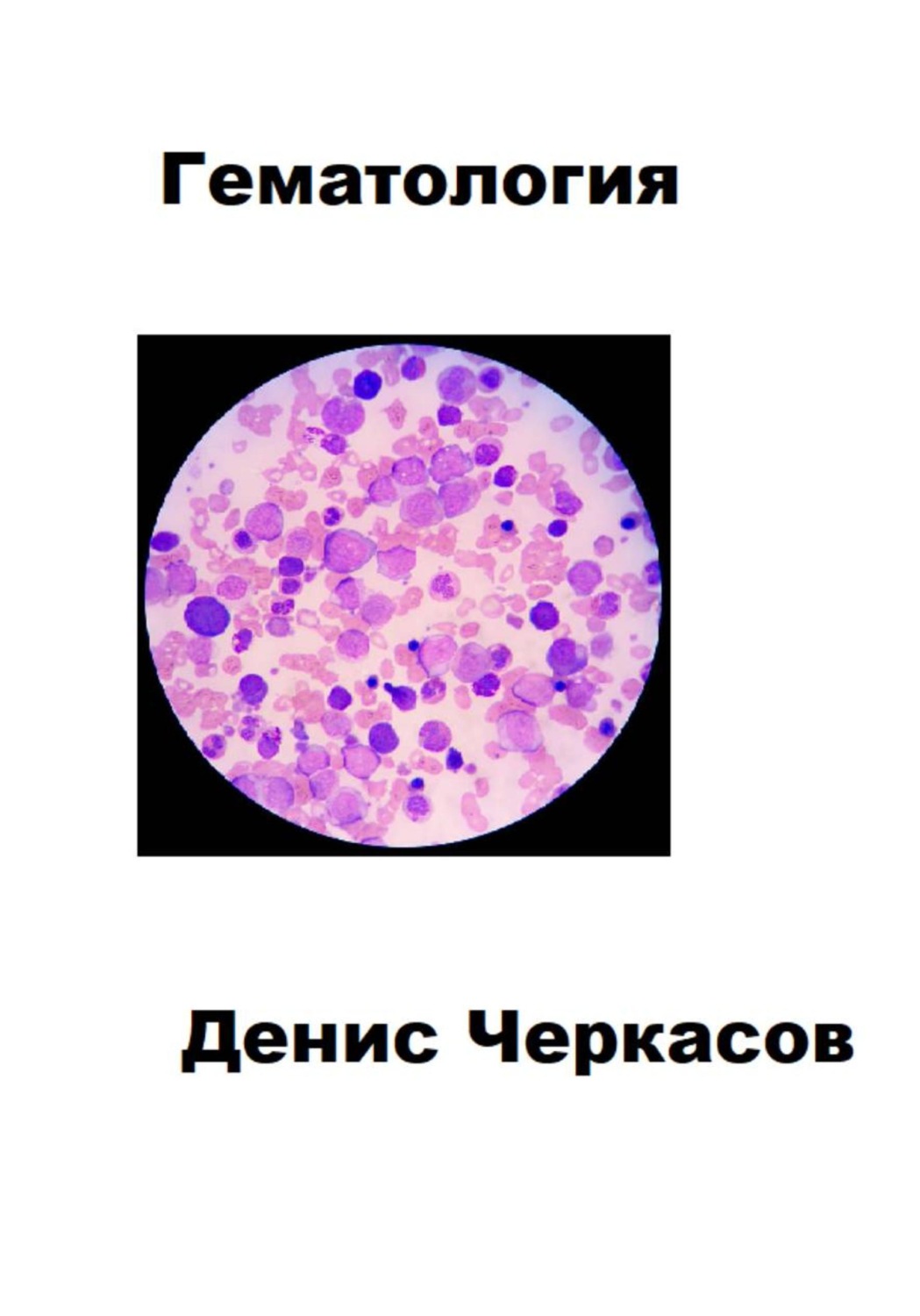 Обложка книги «Гематология»