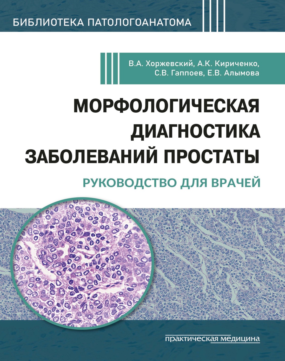 Обложка книги «Морфологическая диагностика заболеваний простаты. Руководство для врачей»