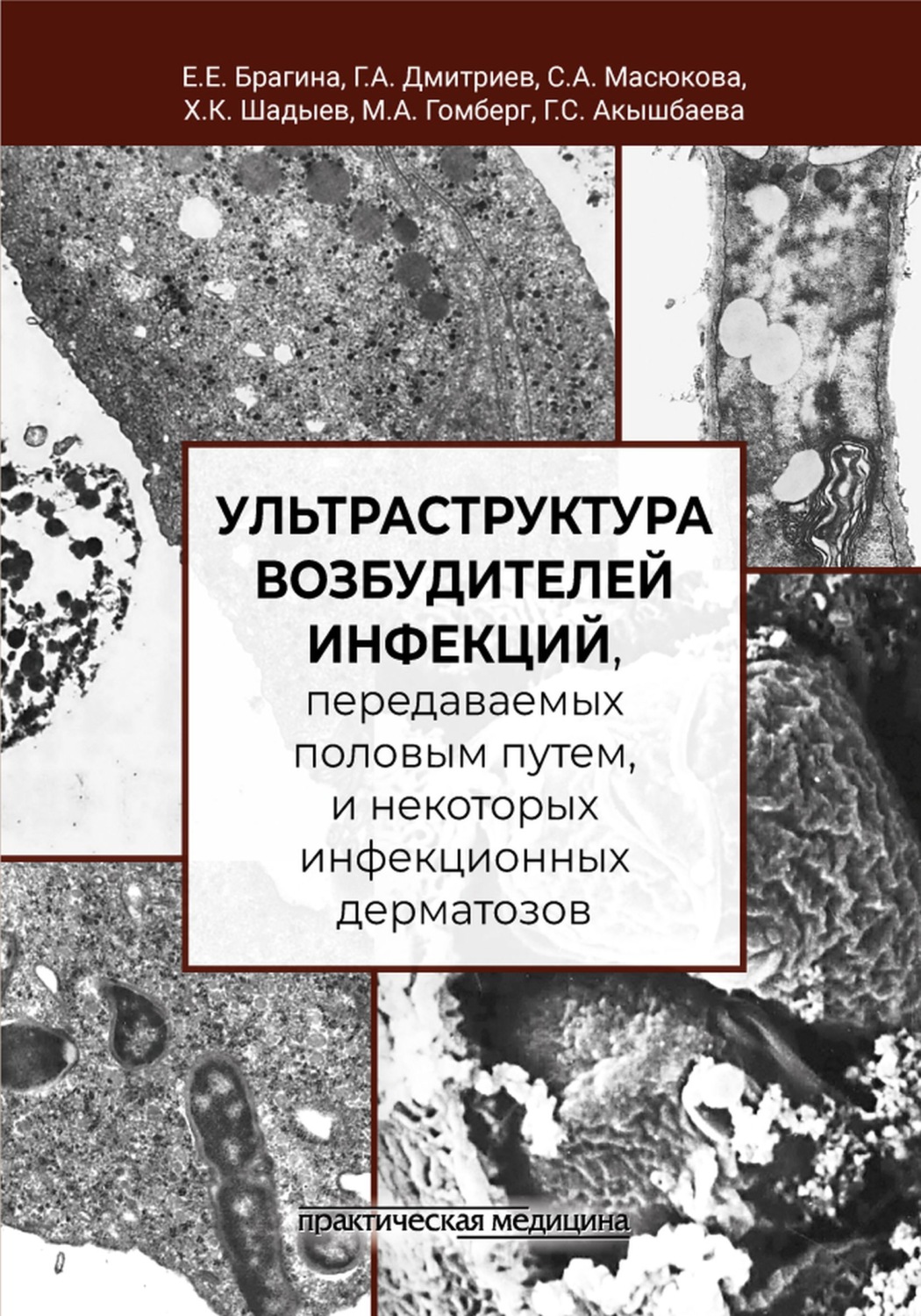Обложка книги «Ультраструктура возбудителей инфекций, передаваемых половым путем, и некоторых инфекционных дерматозов»