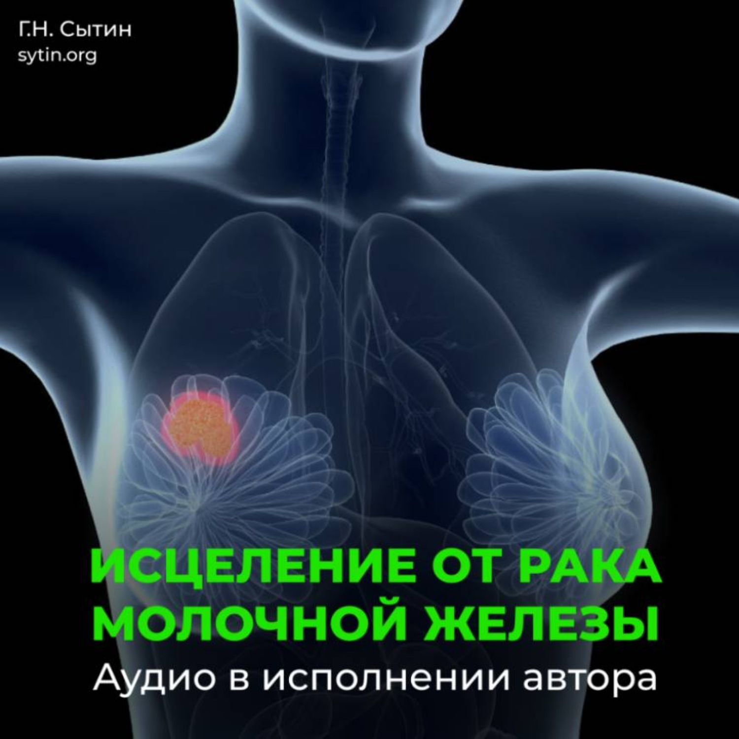 Обложка книги «Рак молочной железы»