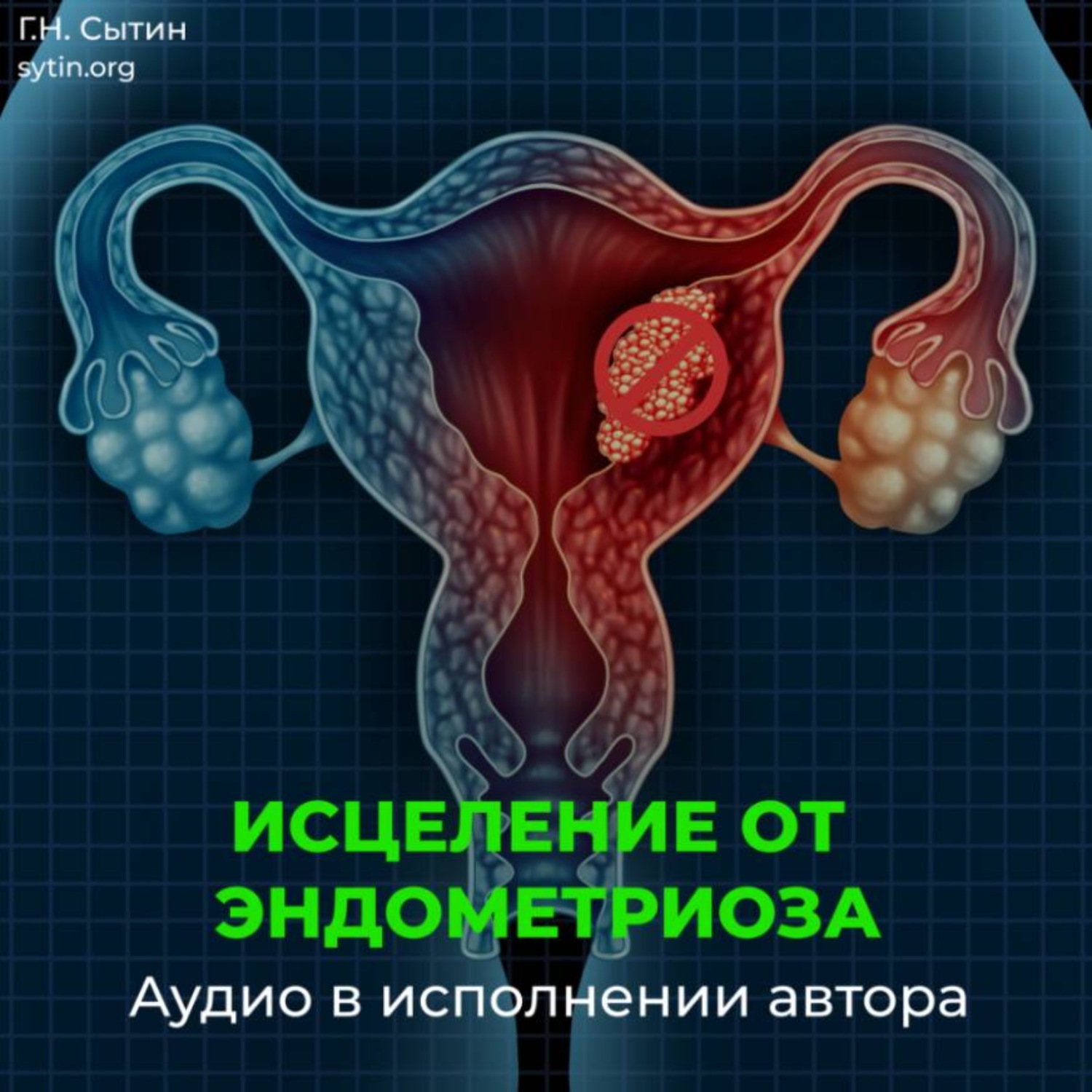 Обложка книги «Исцеление от эндометриоза»