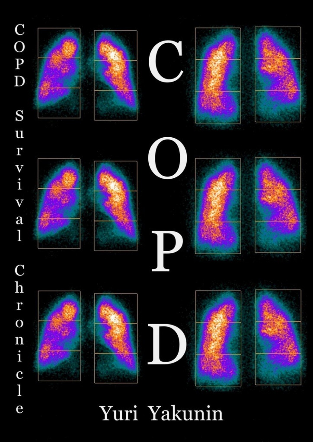 Обложка книги «COPD»