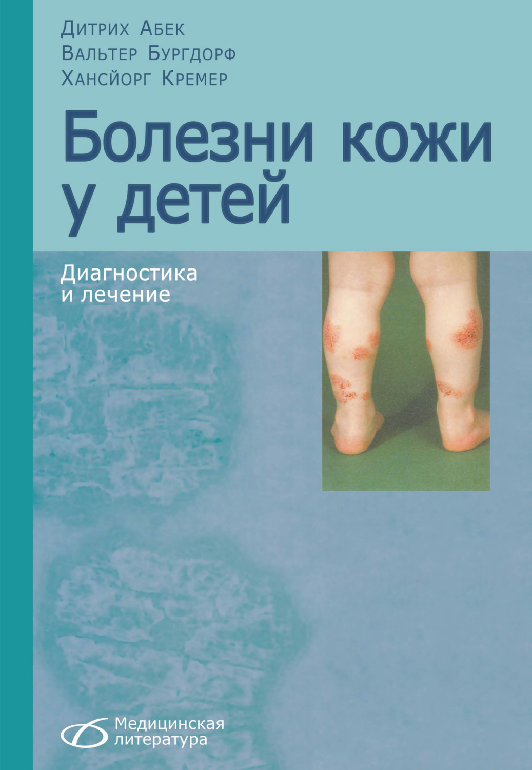 Обложка книги «Болезни кожи у детей»