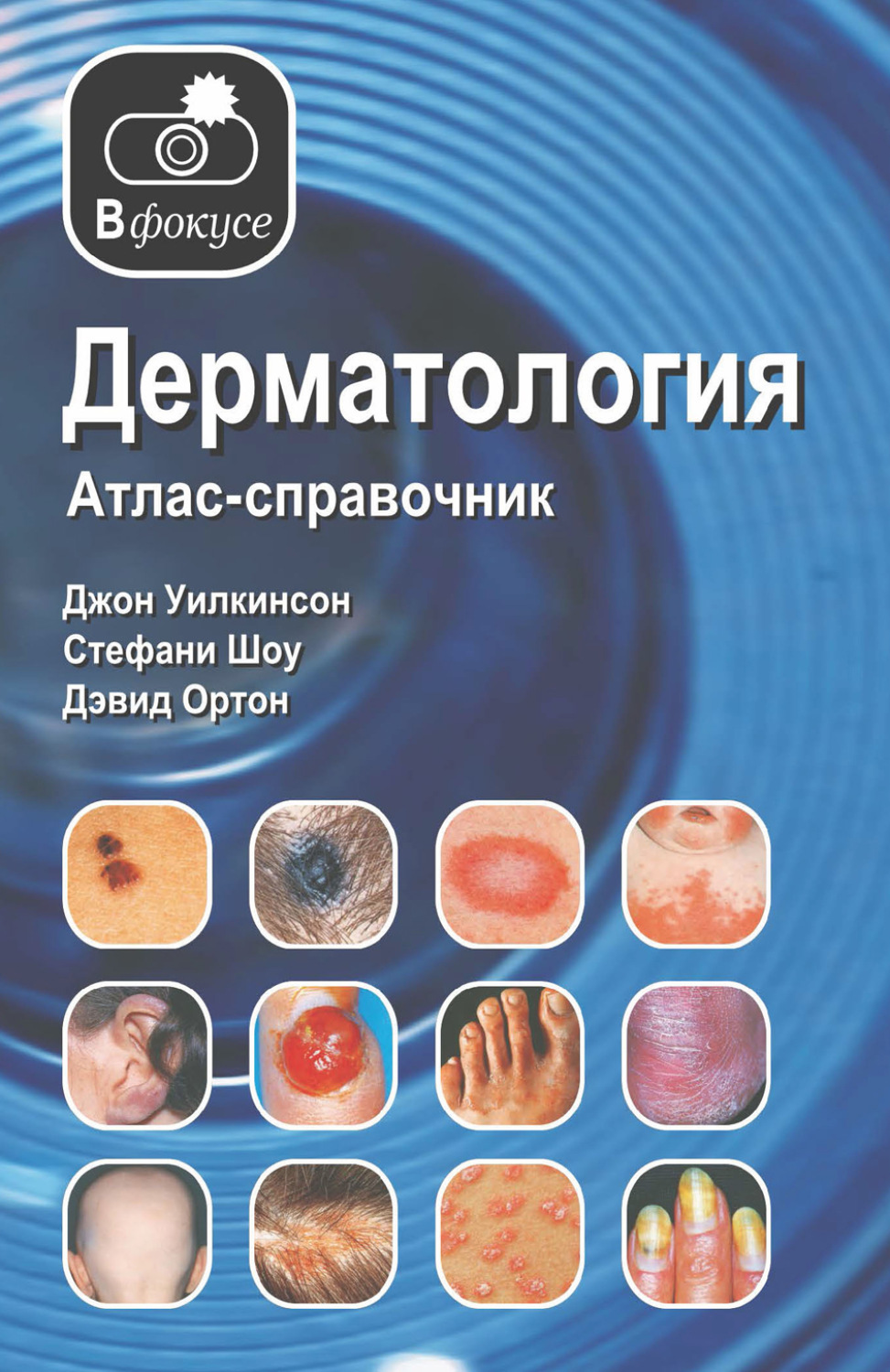 Обложка книги «Дерматология. Атлас – справочник»