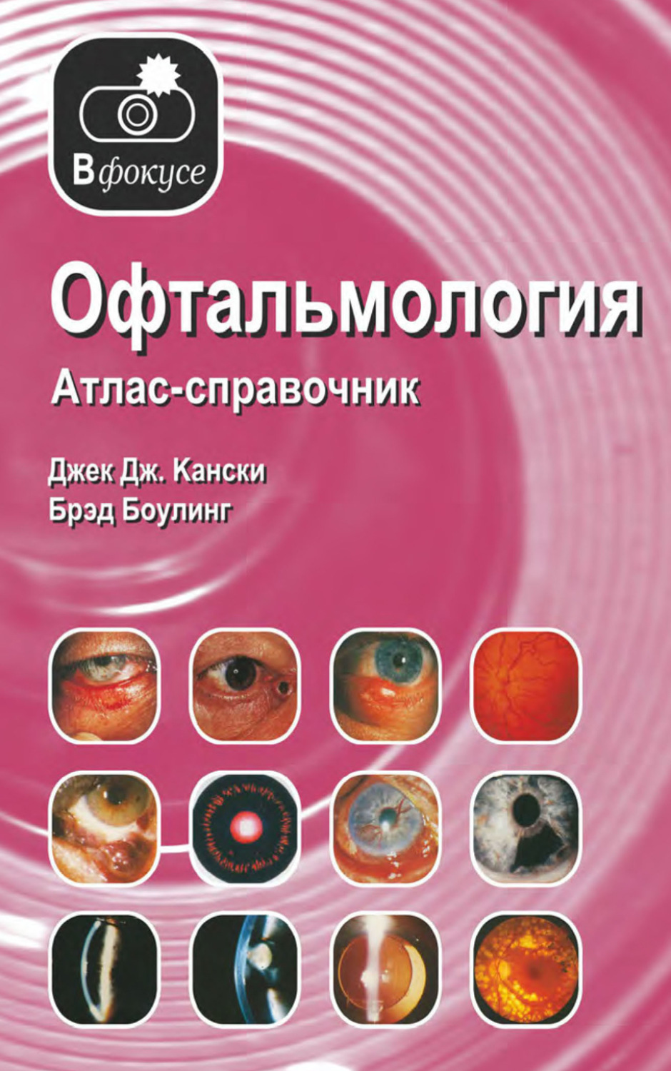 Обложка книги «Офтальмология. Атлас – справочник»