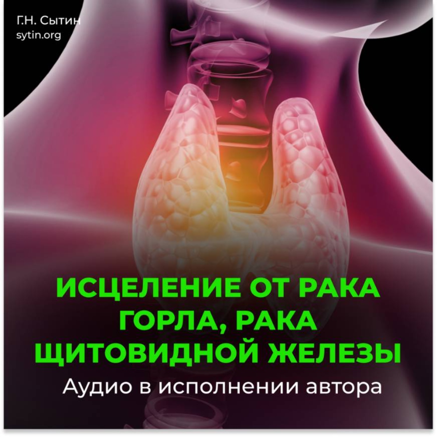 Обложка книги «Настрой Сытина от онкологии горла, рака щитовидной железы»
