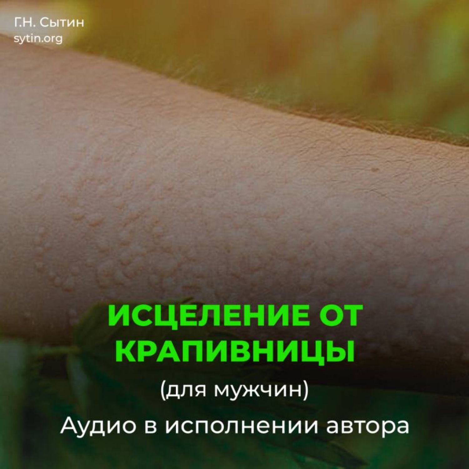Обложка книги «Исцеление от нейродермита, мужской крапивницы»