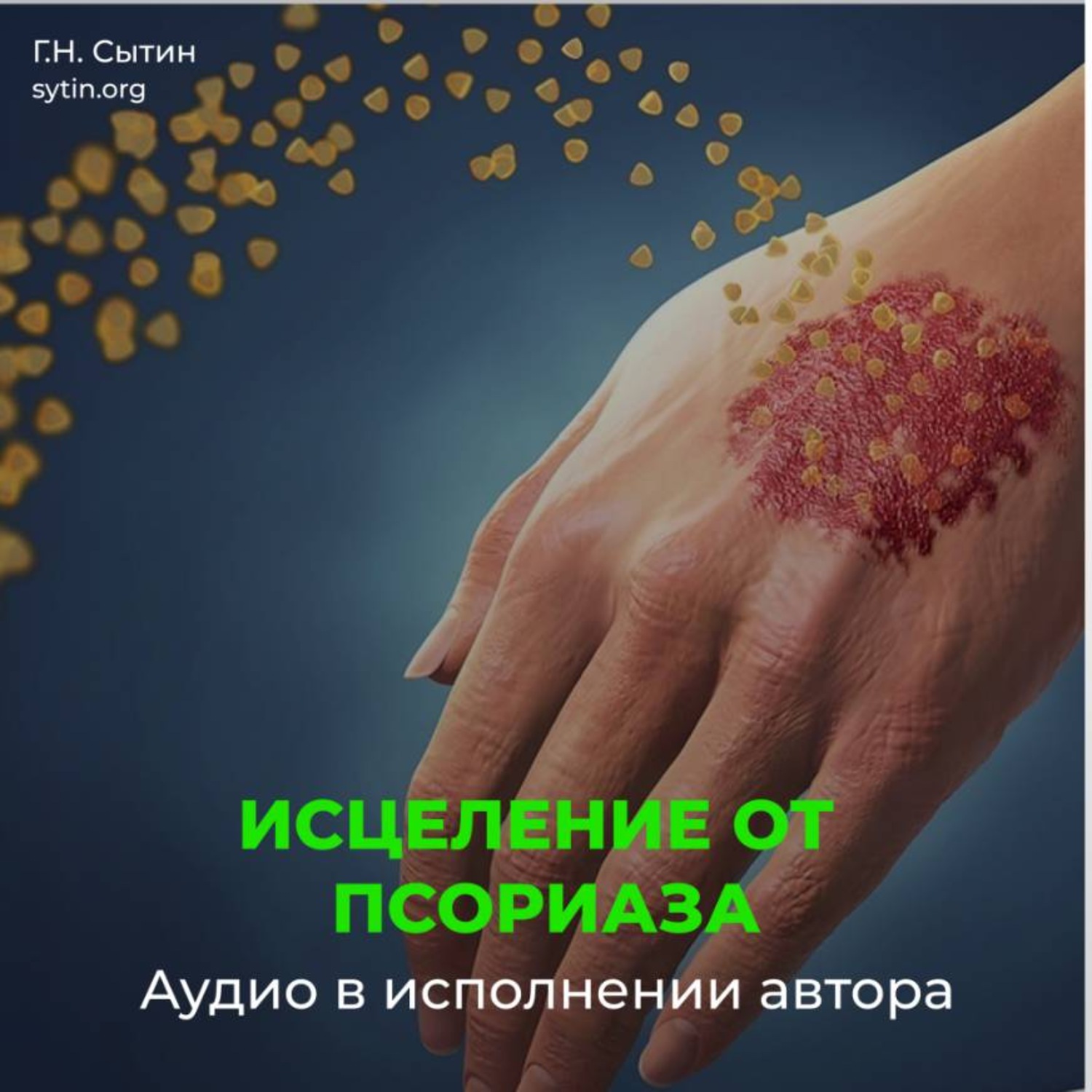 Обложка книги «Настрой исцеление от псориаза»