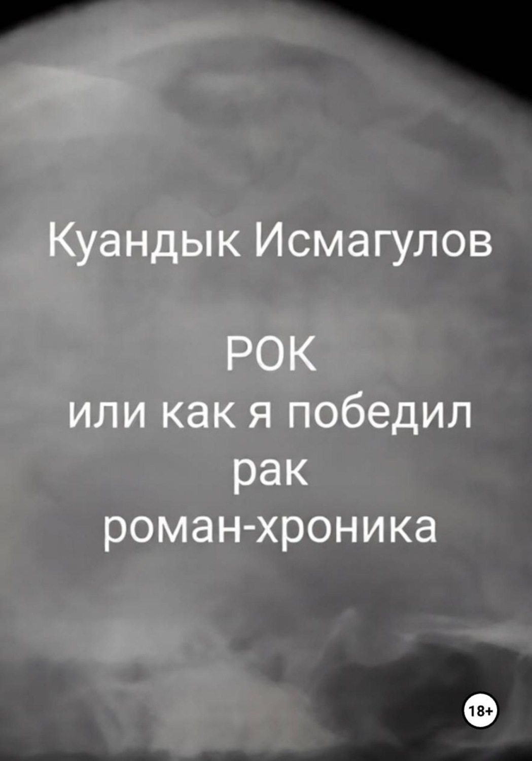 Обложка книги «Рок, или Как я победил рак»