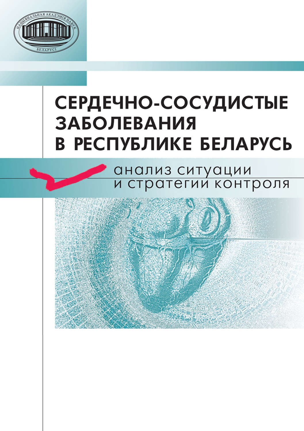 Обложка книги «Сердечно-сосудистые заболевания в Республике Беларусь. Анализ ситуации и стратегии контроля»