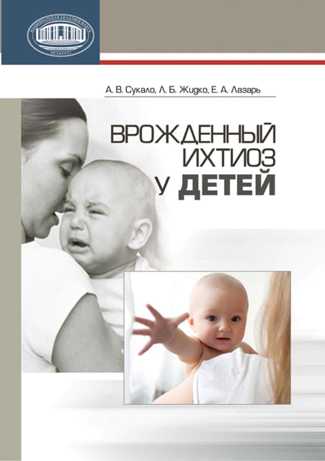 Обложка книги «Врожденный ихтиоз у детей»