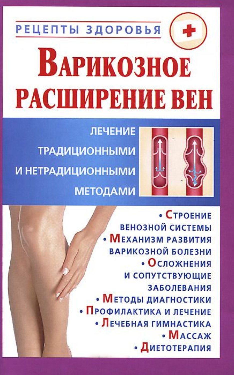 Обложка книги «Варикозное расширение вен. Лечение традиционными и нетрадиционными методами»